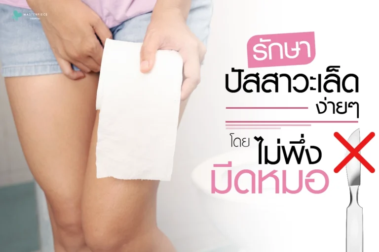 รักษาปัสสาวะเล็ดง่ายๆ-โดยไม่พึ่งมีดหมอ-1200px