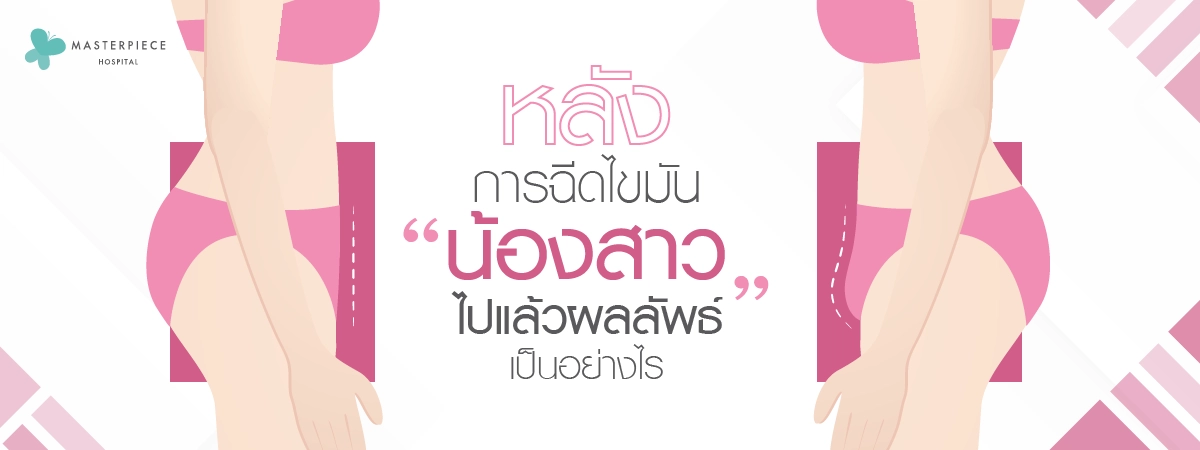 หลังการฉีดไขมันน้องสาวไปแล้วผลลัพธ์เป็นอย่างไร